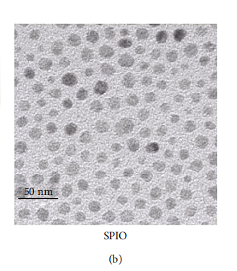 超顺磁性氧化铁纳米（SPION）的MRI在医学领域的应用