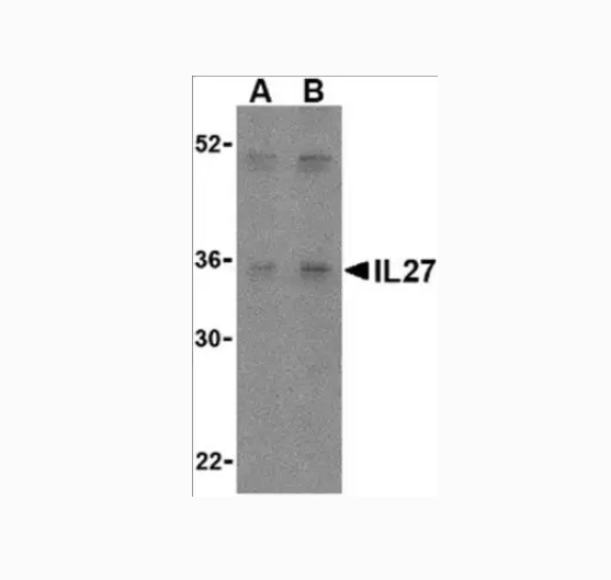 il27修饰的脂质体包fluc mrna  FLUC mRNA-IL-27脂质体载体的特性