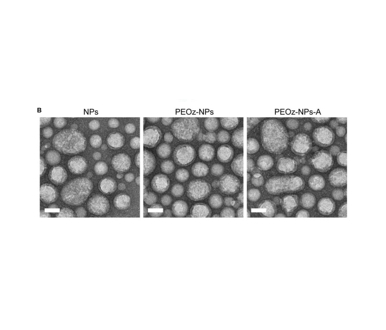 NPs、PEOzs-NPs和PEOzs-NPs-A的TEM成像和DLS