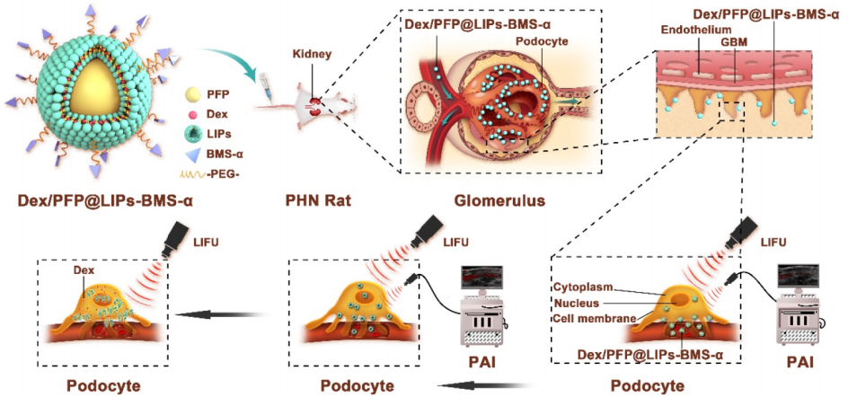 DSPE-PEG-COOH在Dex/PFP@LIPs-BMS-α纳米递送系统中的应用