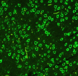 五甲川花菁染料标记Human Fibrinogen