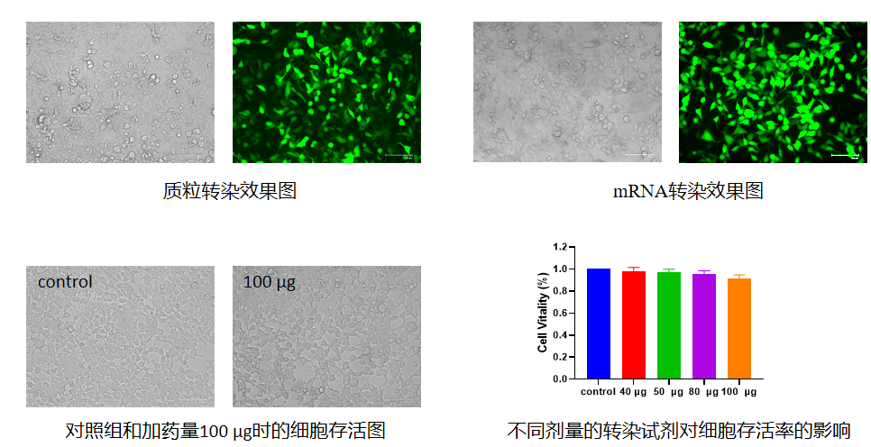 LNPs核酸转染试剂盒