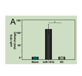 用RGD−PFP-TNDs转染miR-181b或NC后的HUVECs中miR-181b的qPCR分析