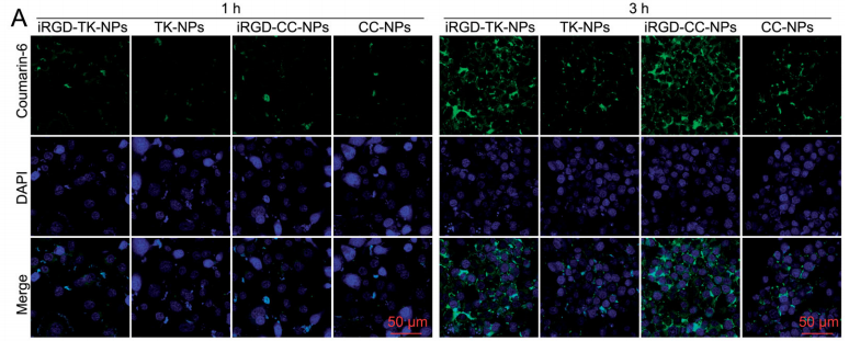 SGC 7901细胞分别与香豆素-6负载的iRGD-TK-NPs、TK-NPs、iRGD-CC-NPs和CC-NPs孵育后的CLSM图像